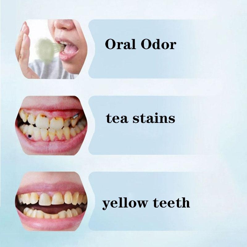 Teeth Whitening  Tooth Stains Yellow Teeth Tartar Removal High-efficiency Whitening Toothpaste Odor Removal