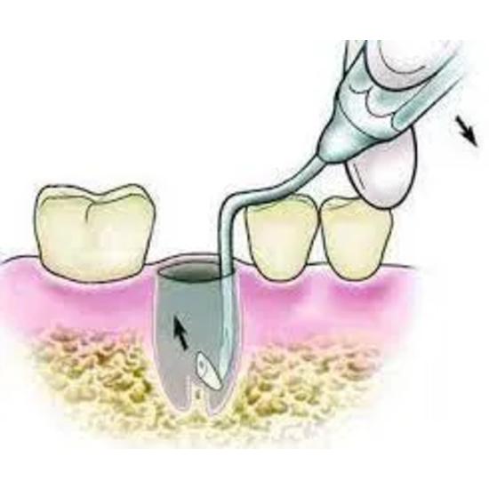 GDC Root Elevators Root Tip Pick Heidbrink - Left (Ehb2)