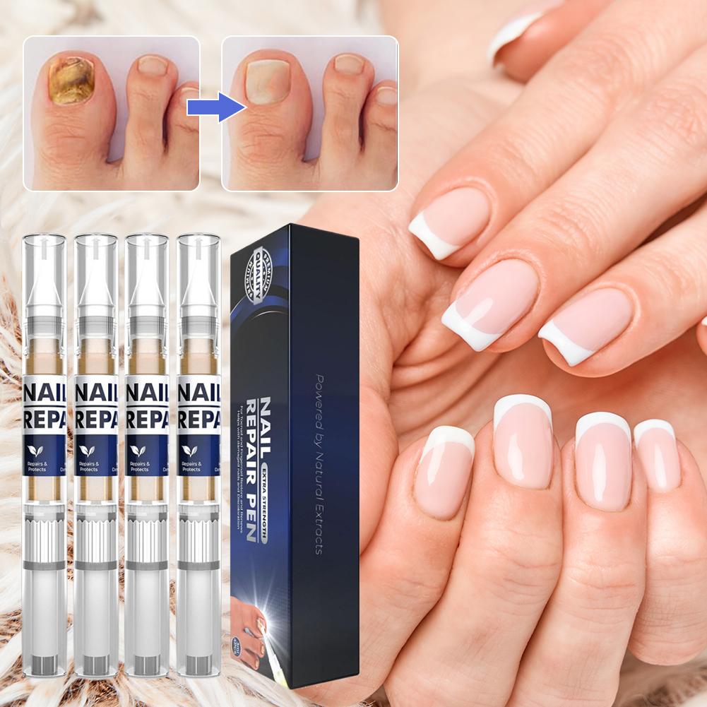 Nail Fungal Liquid Fast Onychomycosis Fungus Nails Demethylation Essential Oil Natural Plant Extracts Nail Shine Nail Care