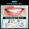 Dr. Oral Whitening Gel, Mint, 60g, Stain Remover, Intensive Whitening Gel, Toothpaste, Removes Teeth Stain, Prevents Tartar Buildup, Gel 74801