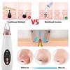 Electric Blackhead Remover Face Pore Vacuum Tool USB Rechargeable Skin Care Acne Pore Cleaner Pimple