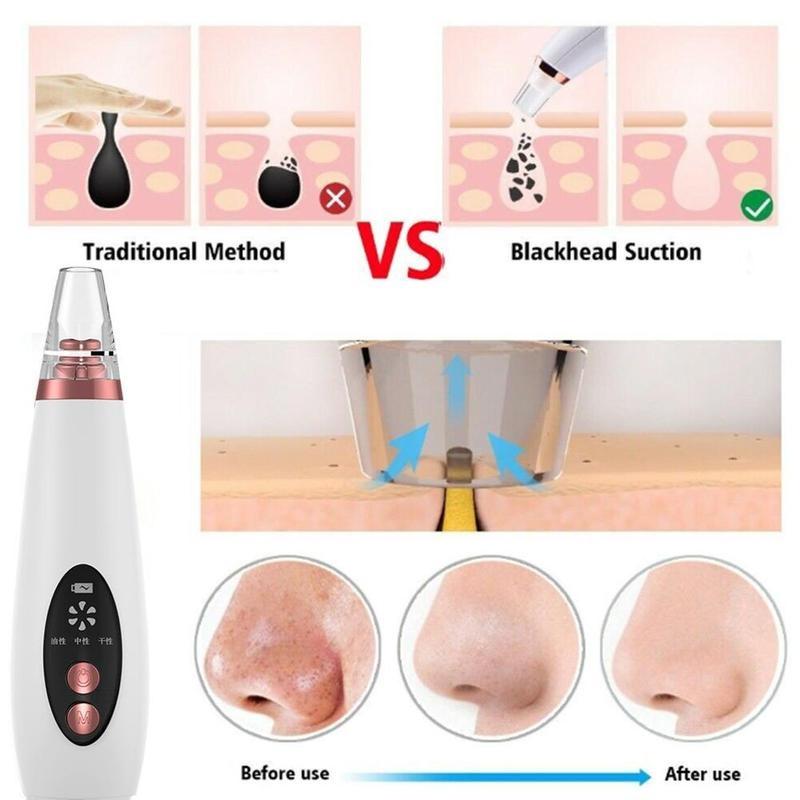 Electric Blackhead Remover Face Pore Vacuum Tool USB Rechargeable Skin Care Acne Pore Cleaner Pimple
