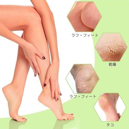 3 Pairs of Women's Silicone Moisturizing Gel Socks with Non-Slip Moisturizing Soles for Full Foot Care, Preventing Roughness and Cracked Feet (Skin, W