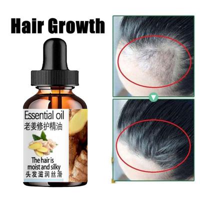 Ingwer-Kräuter-Shampoo, Haarwachstum, Anti-Haarausfall, Anti-Juckreiz, Anti-Schuppen, Ölkontrolle, Erfrischende Kontrolle