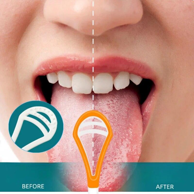 1Pc Tongue Scraper Brush for Oral Care Fresh Breath Tongue Cleaner Removes Bacteria Effectively