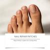 Fungal Nail Hands And Feet Soft Nail Inlaid Nail Thickening Bright Nail Furrow Gray Nail Care Patch .32pcs