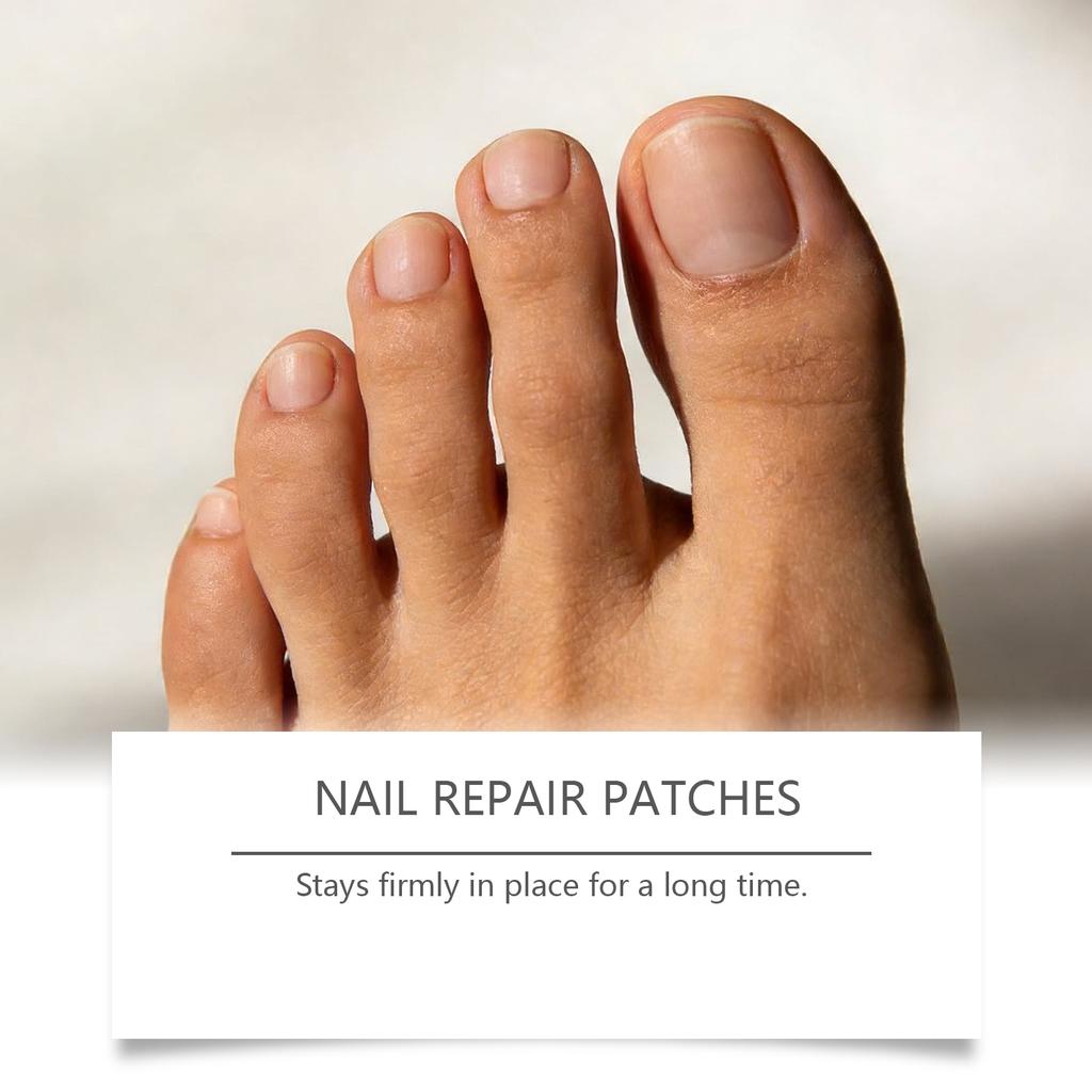 Fungal Nail Hands And Feet Soft Nail Inlaid Nail Thickening Bright Nail Furrow Gray Nail Care Patch .32pcs