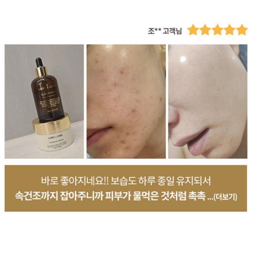 [Lory&Chel] Glorious Essence Ampoule Serum 80g