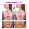 V-face Firming Cream Tightens Contours, Lifts and Tightens Chin and Facial Skin, and Loosens with Massage Cream