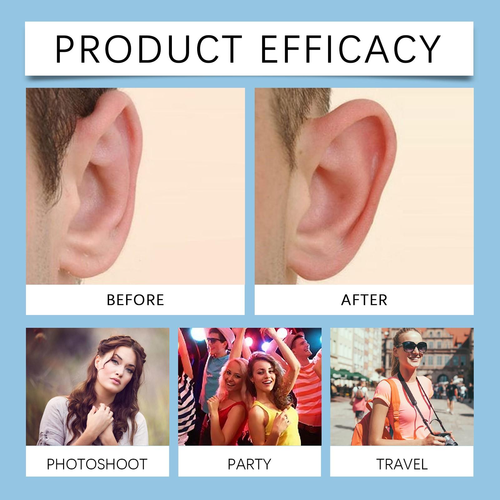 Косметологическая паста для коррекции ушей Паста для ушей Легкая форма для усиления — фото 3