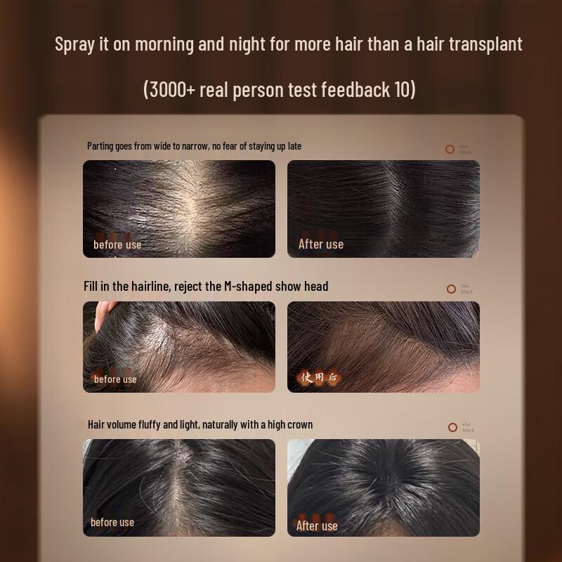 Ruyi Anti-Hair Loss & Hair Growth Serum 100ml