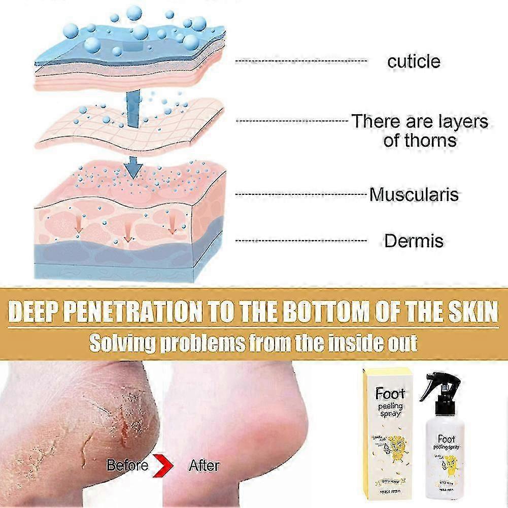 Foot Exfoliation Repair & Brightening Spray Remove Dead Skin Calluses Foot Rejuvenation Treatment 26s