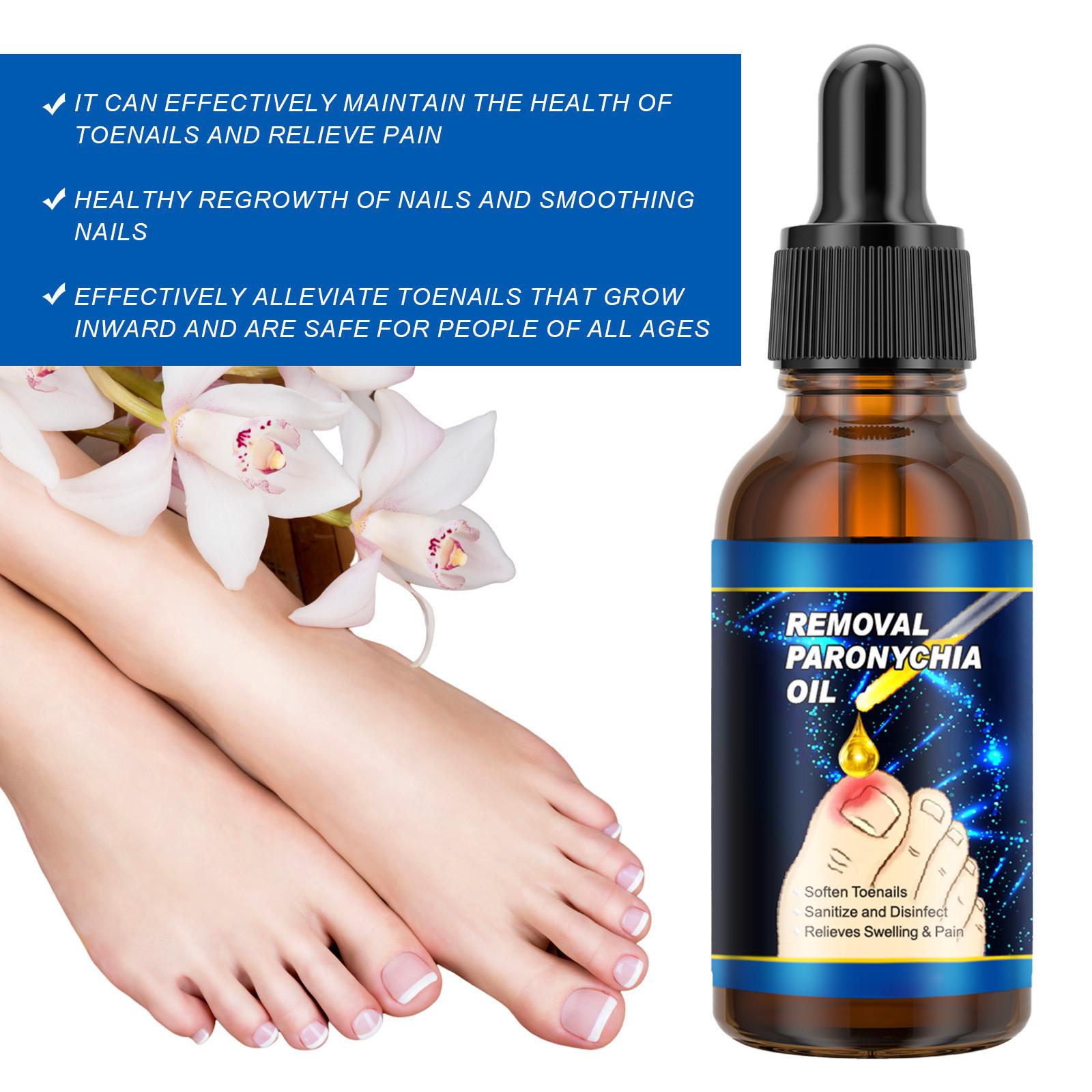 Масло для ногтей от бороздок 30 мл. Масло для ногтей от вросших ногтей — фото 3