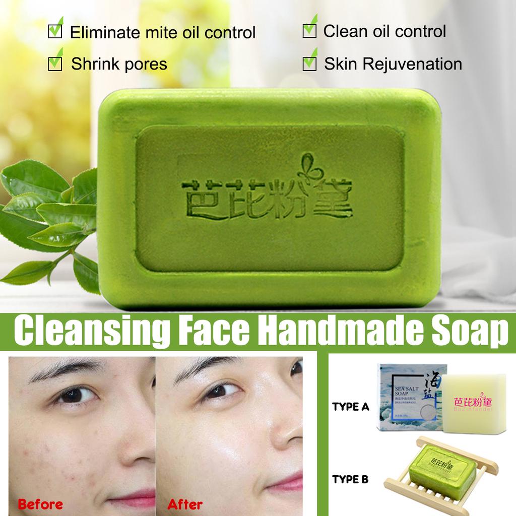 pimple face soap