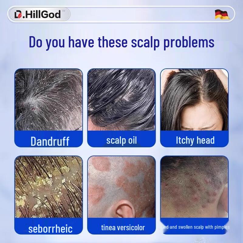 Szampon leczniczy Dr.HillGod z dziegciem węglowym na skórę głowy