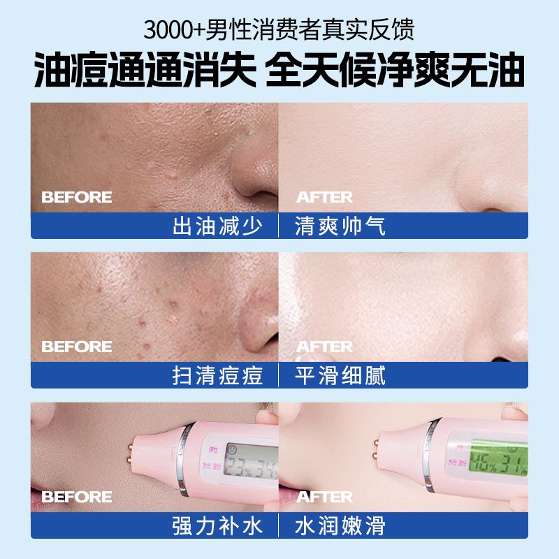[Three Piece Set] Ruyi Salicylic Acid Oil Control & Refreshing Men's Essence Emulsion Set for Moisturizing and Pore Closing