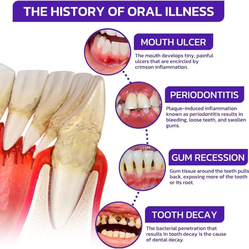 Bee Venom Dental Treatment Toothpaste, Natural Teeth Whitening Toothpaste, Fresh Breath, Natural Ingredients for Men and Women