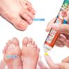 Sumifun 20/40/100 ML Fußjuckreiz Lindernde Creme Reduziert Fußgeruch Schweißbildung Schälen Löst Fußpilz Beschwerden Bakteriostatische Salbe