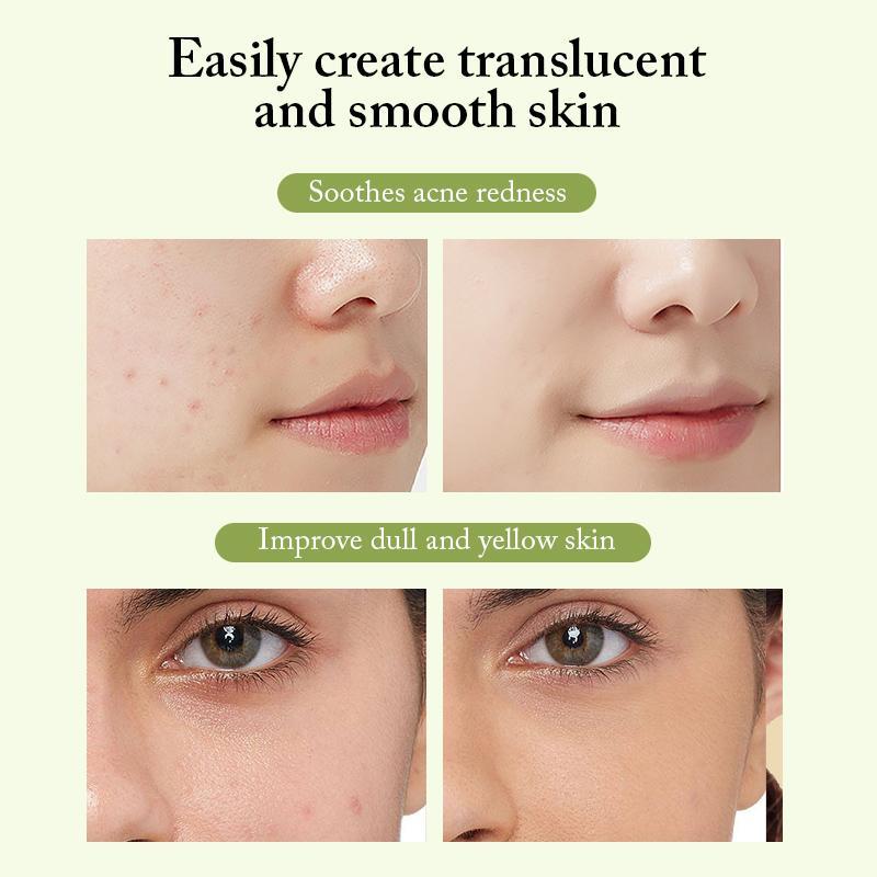 Teebaum-Anti-Akne-Gesichtshautpflegeserum, pflanzliches Anti-Aging-Feuchtigkeits-Whitening-Gesichtsserum