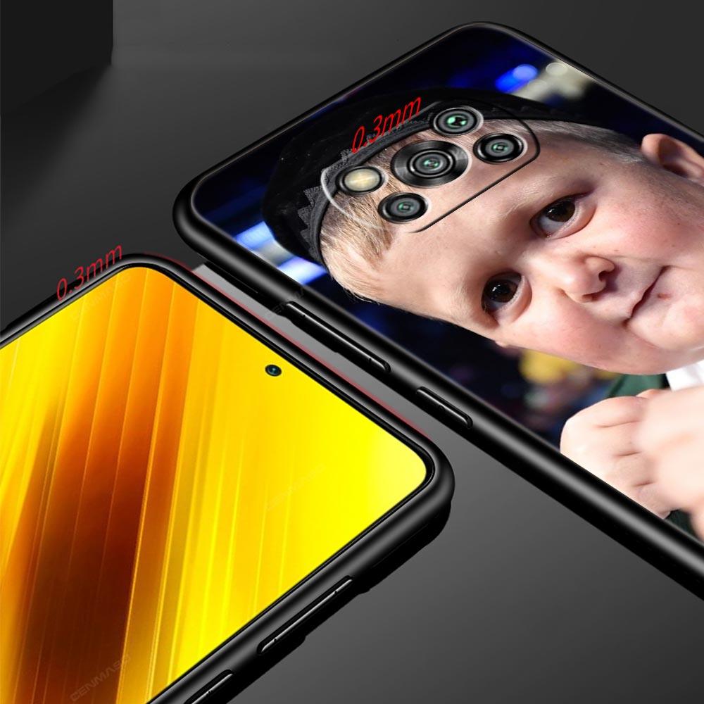 Funny Hasbulla Phone Case For Xiaomi Mi Poco X3 NFC M3 F4 F3 M4 X4 Pro 5G Note 10 12 Lite 11 11T 10T 11X 13 12T Pro 9T Cover