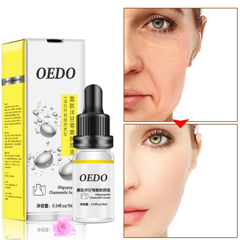 Oligopeptide Chamomile Serum Moistening Whitening Essence Anti Wrinkle Blemish Face Care