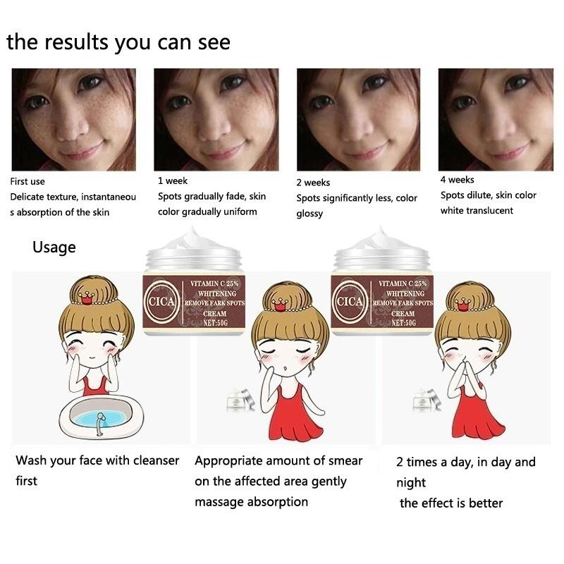 Women New Skin Brightening Cream&Freckle Cream&Dark Spot Corrector Remover for Face & Melasma Blemishes