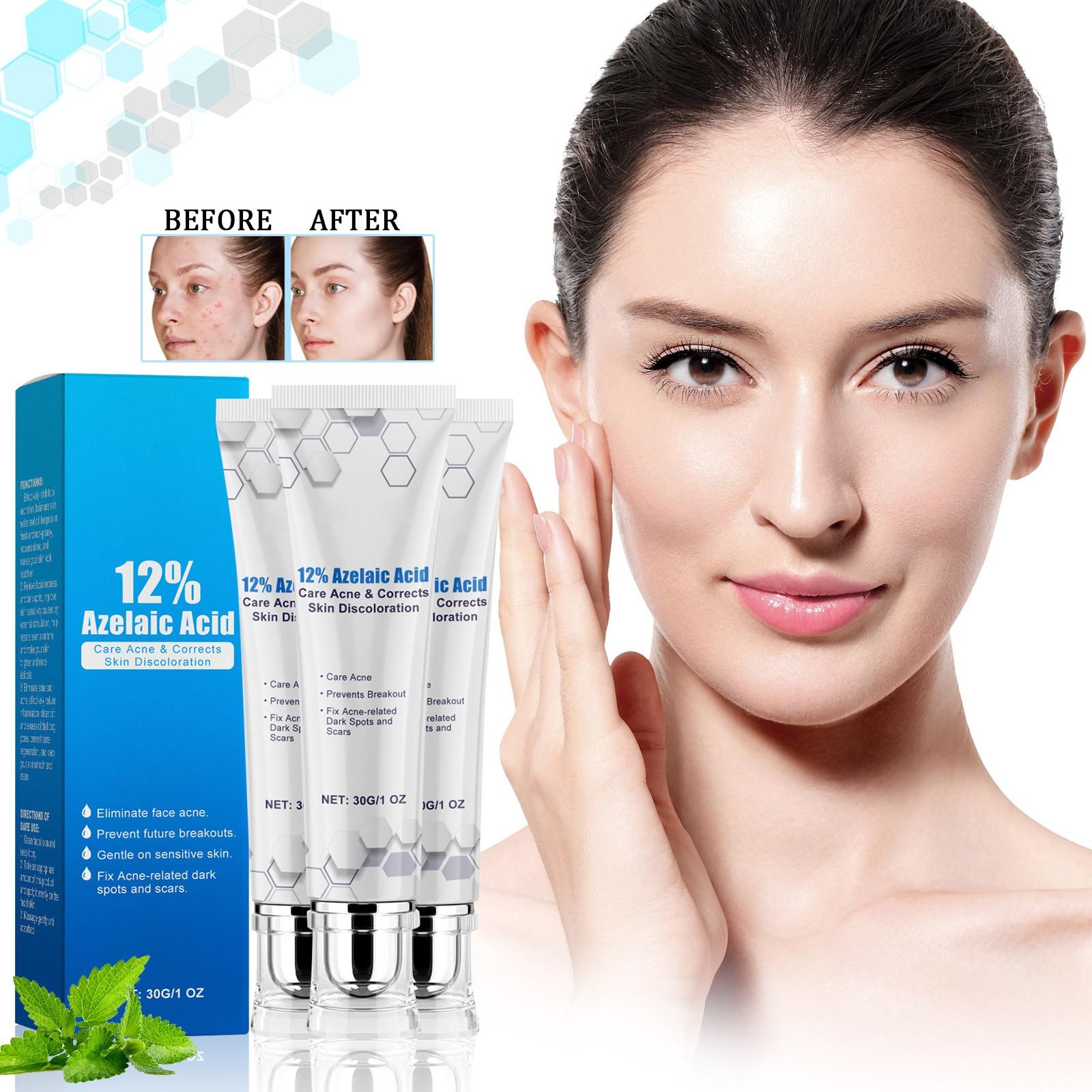 

12% Азелаиновая сыворотка Азелаиновый крем помогает при покраснениях, отеках и прыщах на чувствительной коже30 г1 шт One Size