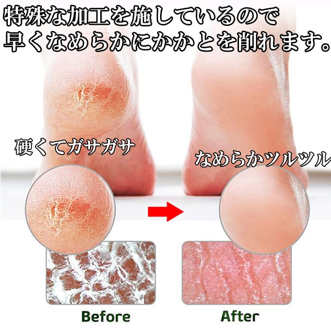 2024 New Glass Heel Callus Heel Heel Sock Heel File with Deluxe Easy to Fully For Wet and Dry Feet [Eooplus] Remover, Sharpener, File, Smooth,