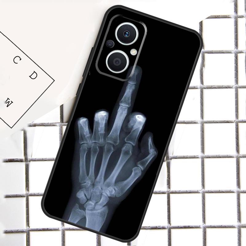 Skeleton Middle Finger Phone Case For OPPO Reno 12F 12 13 11 14 F 10 Pro 8T 7 8 Lite OPPO Find X8 X6 X5 Pro Cover