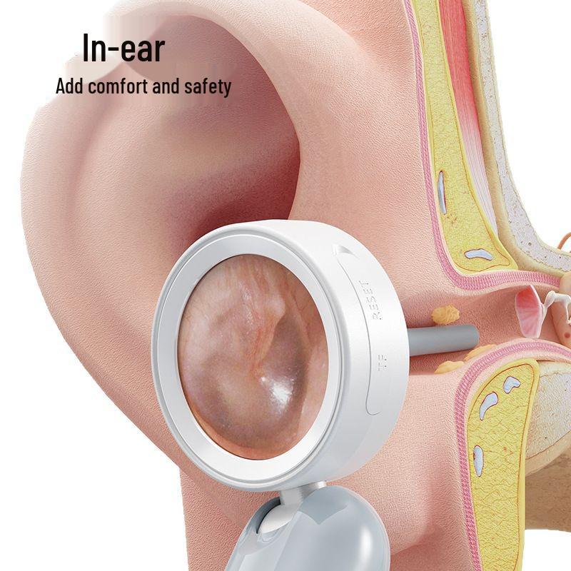 Tragbares Ohr- und Rachenendoskop mit Smart-Display