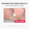Medicube AGE-R Booster Pro Mini Plus (Pink) Skincare Facial Device, Lifting, Wrinkle Relief, 5 Minutes a Day, Experience a Trip to Korea, Vibration Ca