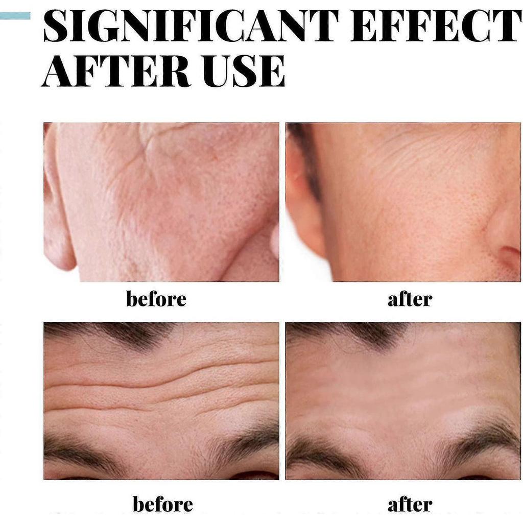 3 Pezzi Crema Antietà Antirughe al Collagene per Uomo - Crema al Collagene per Viso Uomo Idratante, Rassodante e Tonificante Antietà Rughe