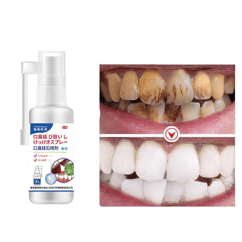 Teeth Whitening  Tooth Stains Yellow Teeth Tartar Removal High-efficiency Whitening Toothpaste Odor Removal