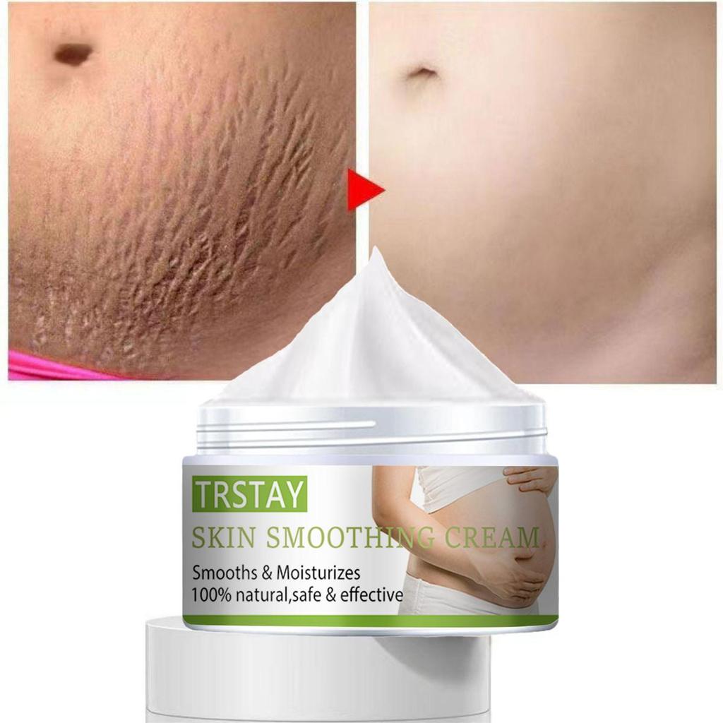 Stretch Mark Cream Pregnant Women Postpartum Stretch Marks  Crema Para Blanquear La Cara Skin Whitening Cream