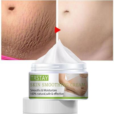Creme para estrias Mulheres grávidas pós-parto estrias creme para clarear a pele creme clareador