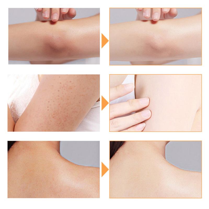 2× Turmeric Soap Skin Whitening Dark Spots Lightening Acne Brightening Turmeric