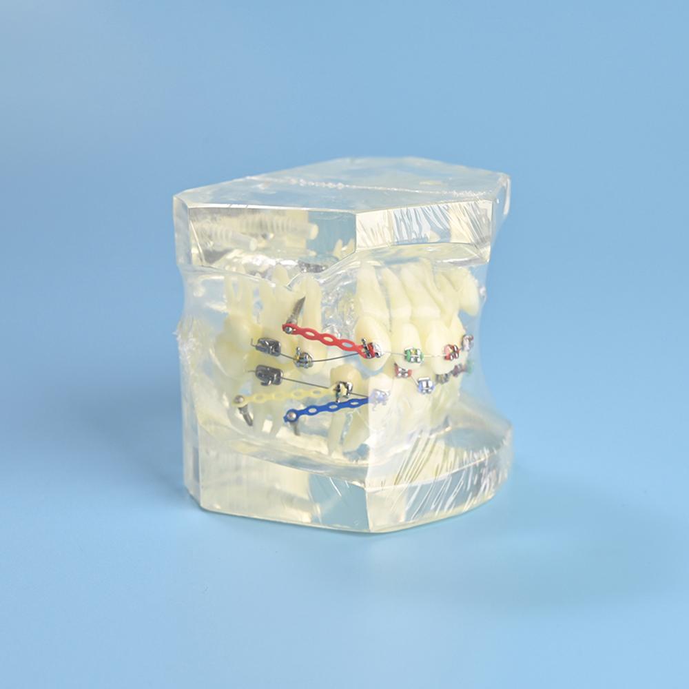 Стоматологическая учебная модель Стоматологическое обучение Эндодонтия Модель зубов Прозрачный цвет С ортодонтическим металлическим брекетом Цветная лигатура