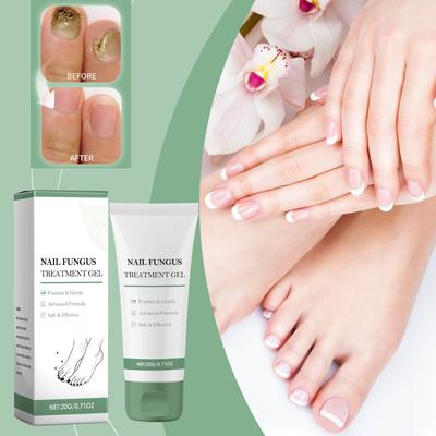 Gel-Pflegelösung für Onychomykose, weicher Zehennagellack, Nagellack, spezielle Salbe zur Pflege eingewachsener Nägel und Granulome.