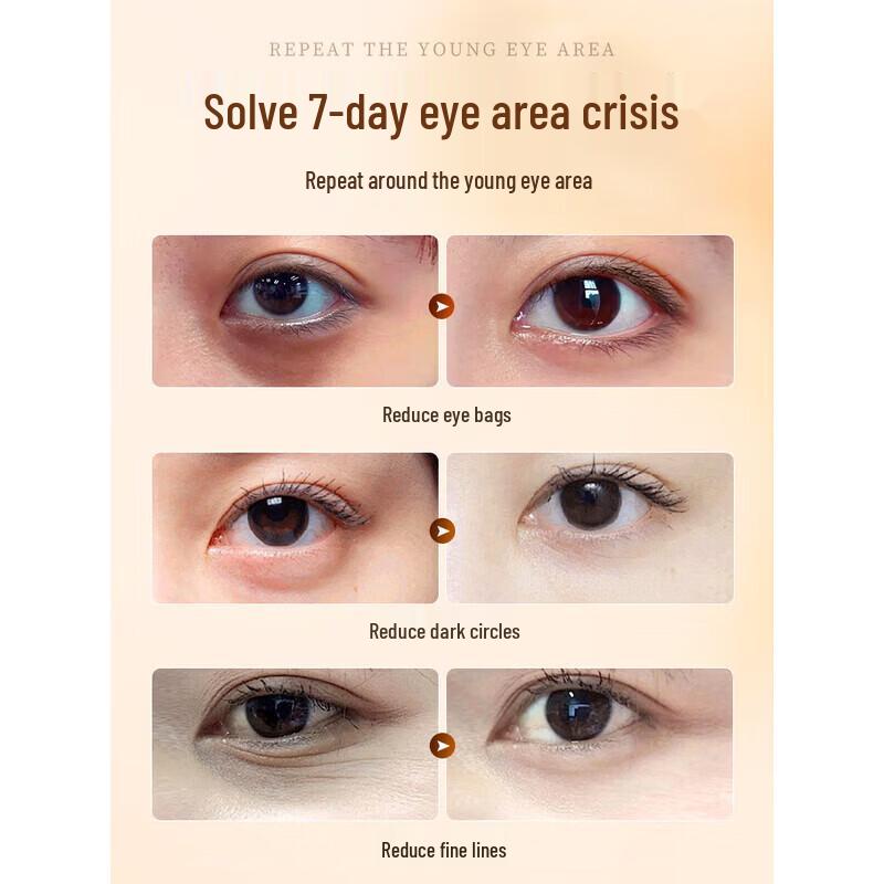 RUYI Anti-Aging Eye Serum Oil