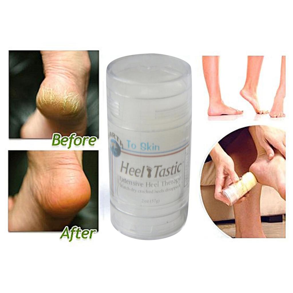 Cracked Heel Repaired Paste 2oz, Foot Paste For Dry Cracked Feet, Cracked Heel Care Enriched Foot Lotion