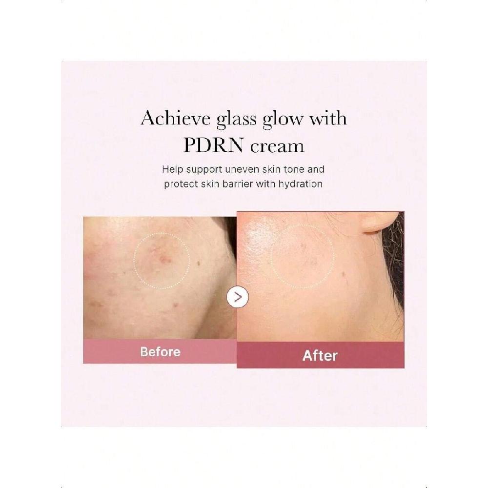 Medicube Lachs-DNA PDRN Rosa Hyaluron Feuchtigkeitscreme 50ml Rosa Beruhigungscreme, Hydratisierend & Straffend, Unebenmäßiger Hautton, Porenpflege