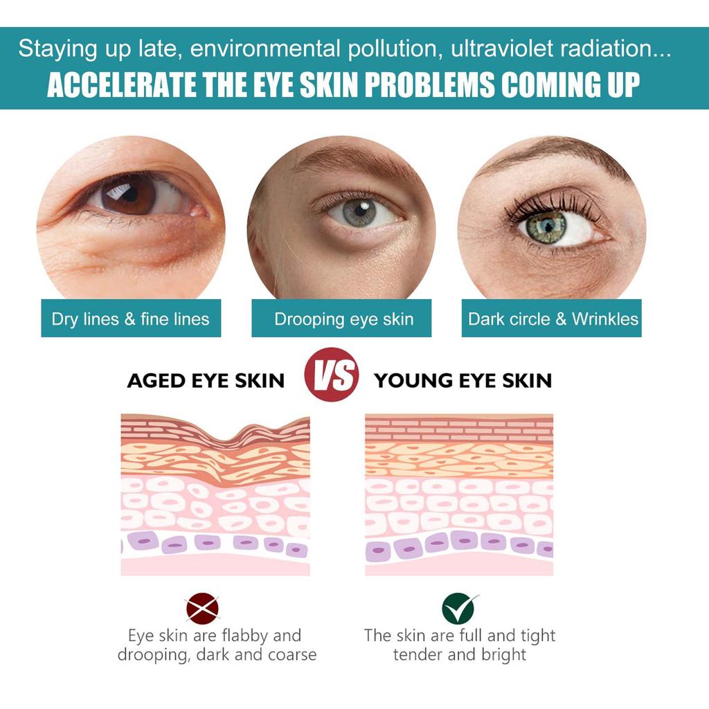 EELHOE Gel pentru ochi anti cerc întunecat Îngrijirea pielii Peptide Pungi pentru ochi Cremă cu acid hialuronic antirid Masaj cu role Frumusețe Sănătate