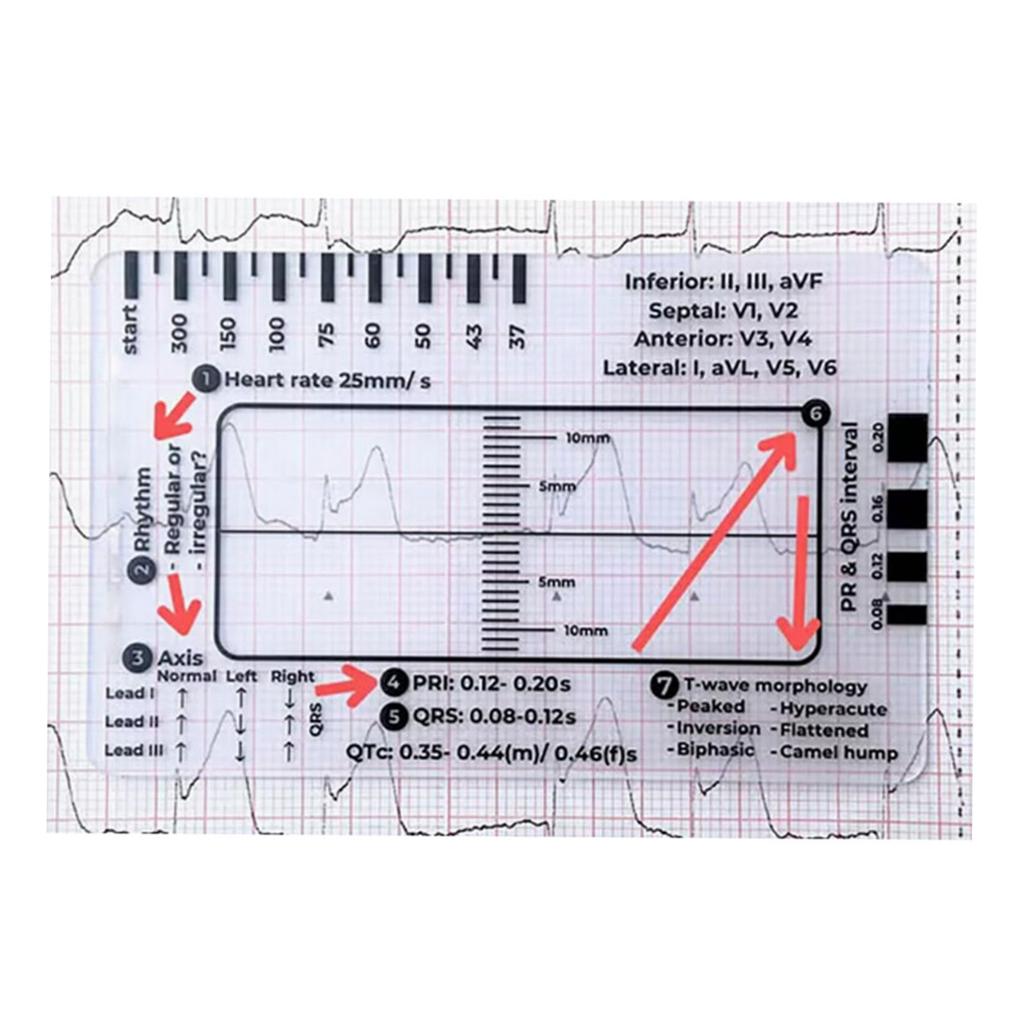ECG 7 Step Ruler Card Portable Pocket ECG Interpretation Tool 7 Step Ruler Card Device for Quick & Accurate Measurements