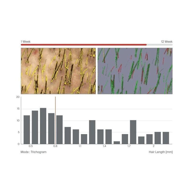 Dr.FORHAIR - Folligen Original Shampoo Jumbo