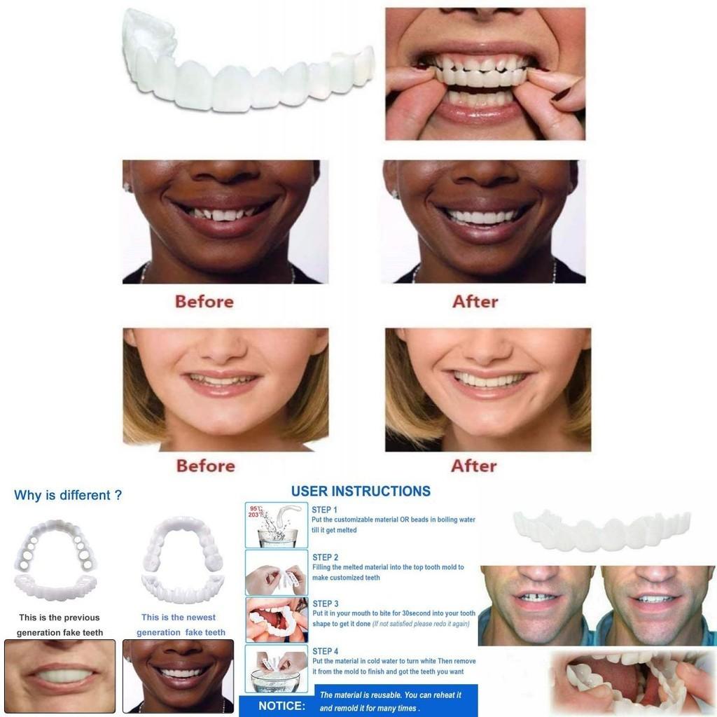 Fake On Snap Teeth Upper Lower Dental Veneers Denture Tooth Cover Set Simulation