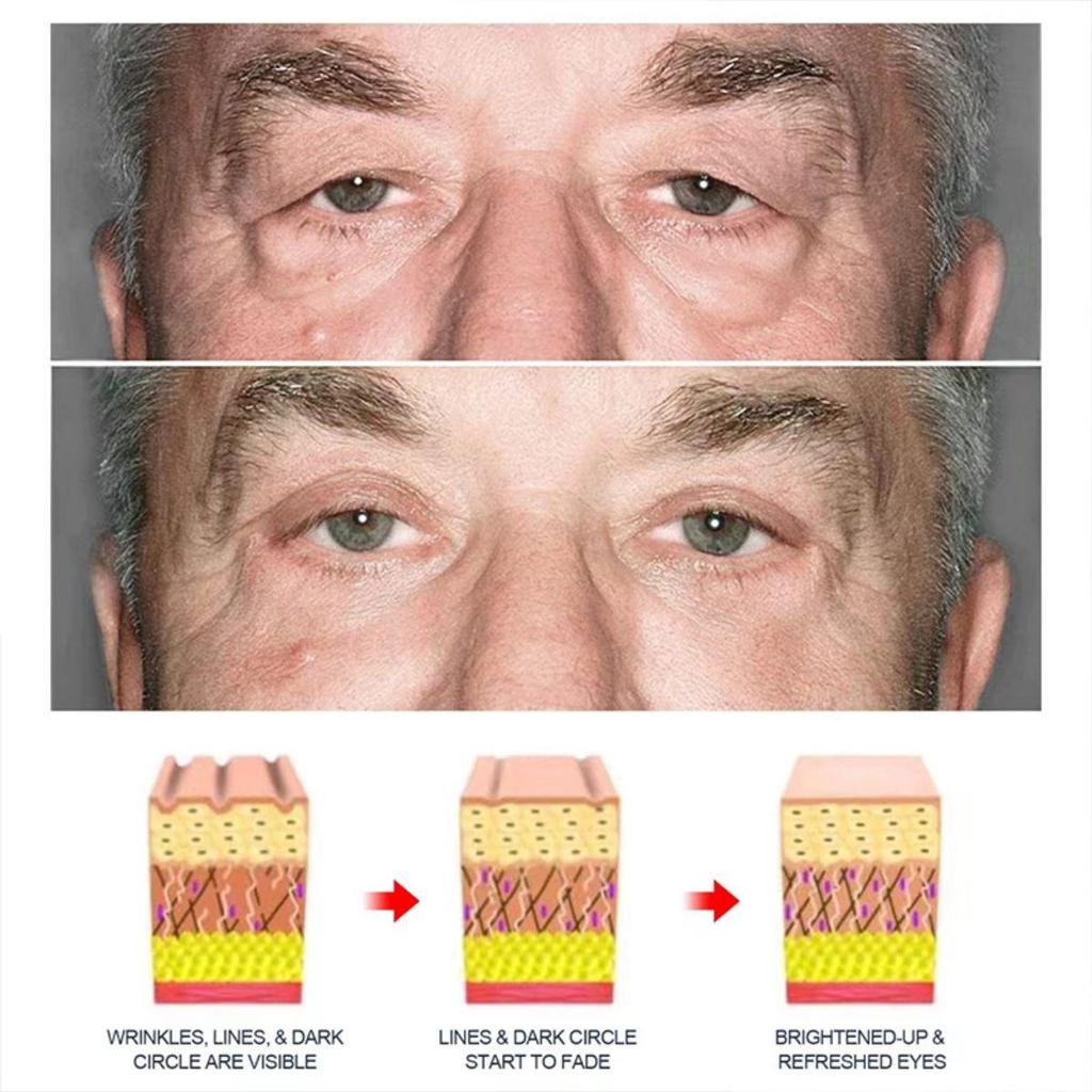 Face Cream Lifting Anti Aging Anti Eye Bags Moisturizer Facial Treatment