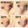 Piercing Healing Silicone Discs Transparent Disc Pads for Fixing the Earrings