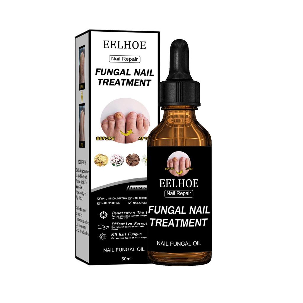 EELHOE Nail Repair Lotion – Brighten Nails, Remove Gray Nails, Repair and Moisturize, Nutritious Nail Care Solution