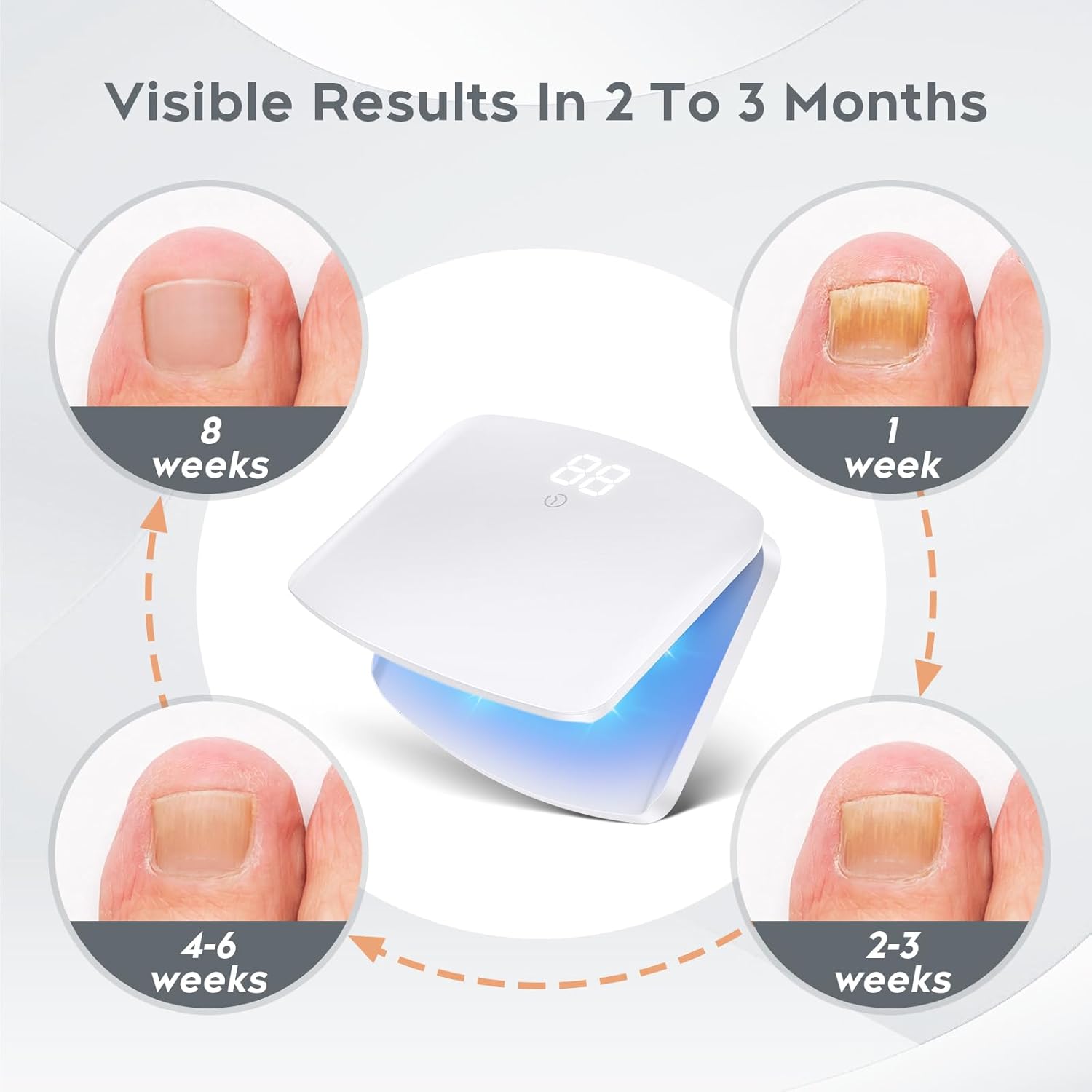 

Nail Fungus Light Device for Multiple Fingernails & Toenails, Home Use Nail Light Device for Restores Appearance of Discolored or Damaged Nails, белый