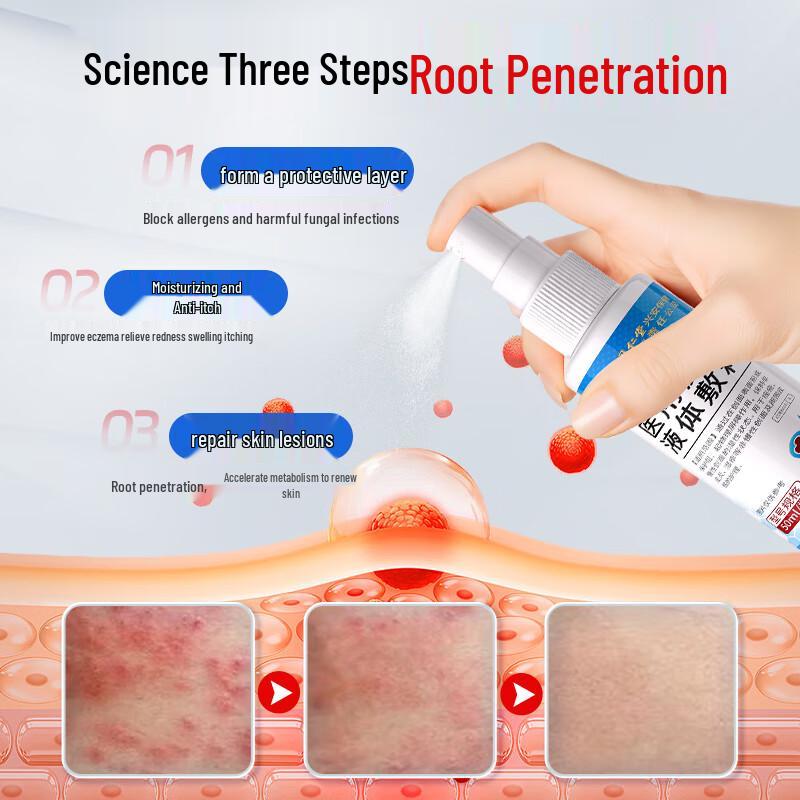

Tong Ren Tang Skin Itch & Eczema Relief Solution